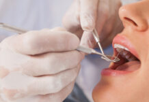 Caso Visodent, importante vittoria per i pazienti: il Tribunale di Ragusa sospende l’obbligo di pagamento delle rate a Compass